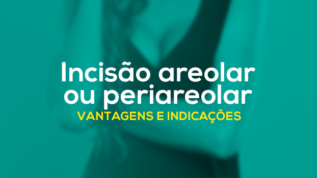 Incisão areolar ou periareolar: vantagens e desvantagens