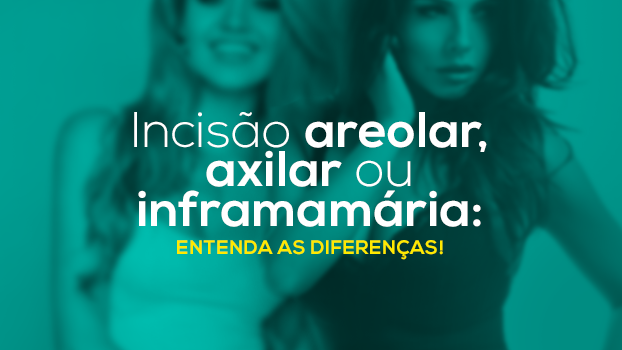 Incisão areolar, axilar ou inframamária: entenda as diferenças!