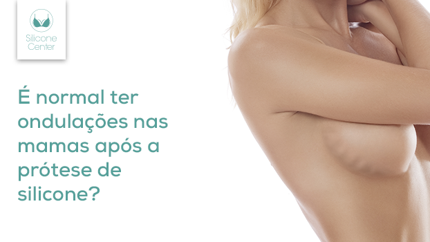 Ondulação na prótese de silicone: como identificar e solucionar o rippling