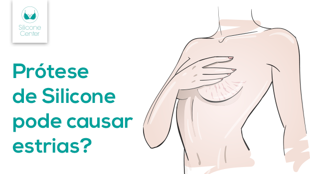 Prótese de silicone pode dar estrias? Descubra o que pode acontecer com seus seios!