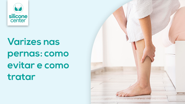 Varizes Nas Pernas: Como Evitar e Como Tratar