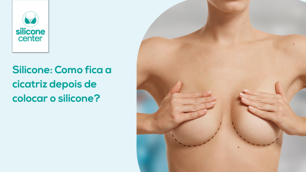 Silicone: Como fica a cicatriz depois de colocar a prótese? 