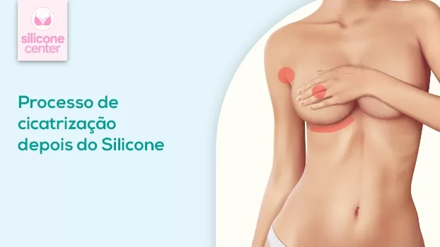 Processo de cicatrização passo a passo: o que acontece depois do silicone?